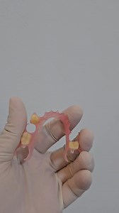🦷 Looking for a more affordable, comfortable denture option? Try flexible dentures — no metal, more comfort, and a natural look! 😁 ✅ Lightweight ✅ Affordable ✅ Easy to wear 📩 Message us now to book a FREE consultation! #FlexibleDentures #AffordableSmile #DentalCare #DentaHPMalate | Denta HP Malate