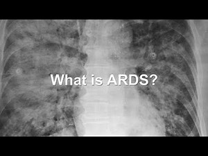 Developing New Treatments for ARDS, A Devastating Condition