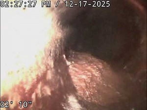 Unit #1 sewer camera inspection