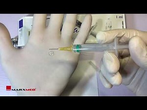 Dissolving Dermal Fillers with Hyaluronidase.