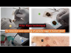 Kito- Katz technique for detection and counting of parasite eggs in human stool