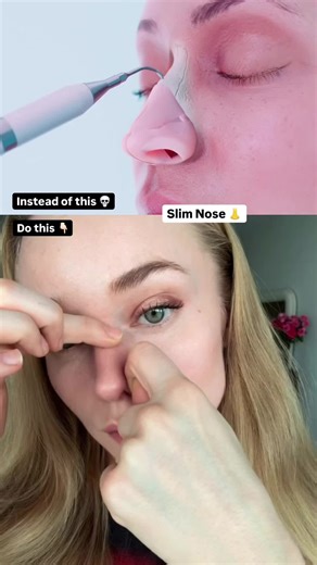 If the tip of your nose looks heavier or more pulled downward, look to the side of the nose, not the nose itself. There’s an a levator muscle here that becomes overactive very easily. It tightens when we sneeze, grimace, squint, or hold facial tension. Over time, it shortens and keeps pulling. That constant pull can: \t•\tmake the nose tip appear droopier \t•\temphasize small folds next to the nose \t•\tcreate a heavy, tense look in the midface Not because of skin. Because of muscle tone. When y