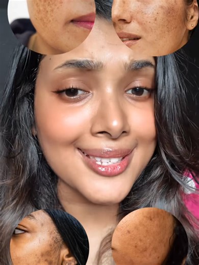 💯💯Just 3-5 drops a day with Bakuchiol Retinol Serum: ✅All in 1: Lifting - Wrinkle Reduction - Skin Brightening - Dark Spot Prevention✅No side effects ❌No time wasted ❌Low cost👍Save 90% compared to Laser, Filler, Meso, Spa, Cosmetics❣️❣️Always love yourself and beauty is the best way❣️❣️🌷If you are still worried about premature aging, order Bakuchiol Retinol Serum now to preserve your youthful beauty!😍Get a limited-time offer: 50% OFF#skincare #beauty #whitening #bakuchiolserum #venature #ba