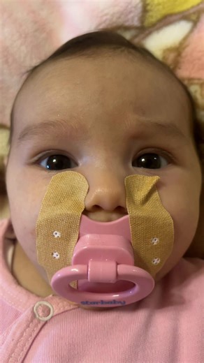 Esl cirpilmali usaq😂😂😂 | esl