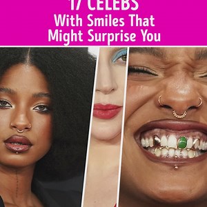 17 Celebs With Smiles That Might Surprise You | CelebRatings