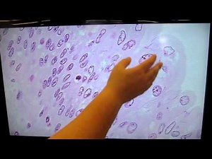 A&P1 Lab#3 transitional epithelium