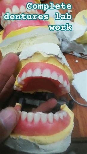 complete dentures lab work #dentallab #dentist #dentalclinic #destacar #dental #aliadentallab #short