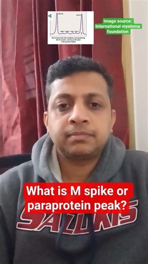 What is M spike or paraprotein peak?
