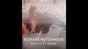 "He is my little miracle" ﻿Baby Richard won a Guinness World Record earlier this year for being the world’s most premature baby to survive, born at just 21 weeks and 2 days old. Baby Richard proves why all babies, regardless of their age and level of development, deserve to be protected from abortion. “The fact that abortion is legal up to 40 weeks is outrageous… If people really saw what a 21-week baby looked like, they would be looking at a baby.” | Live Action