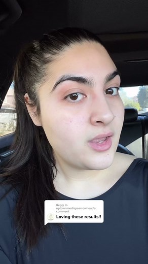 Laser Hair Removal: My Transformation After 4 Appointments