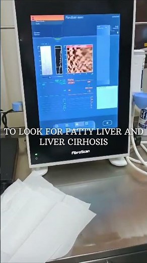 Fibroscan of liver - For Fatty liver and cirrhosis of liver.