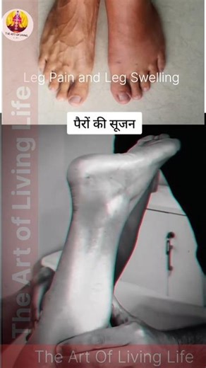 Leg pain & leg swelling do accupressure Massage on leg Do it for 2 minutes #legswelling