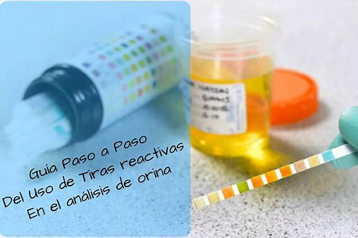 Tiras reactivas en análisis de orina: Guía de uso paso a paso