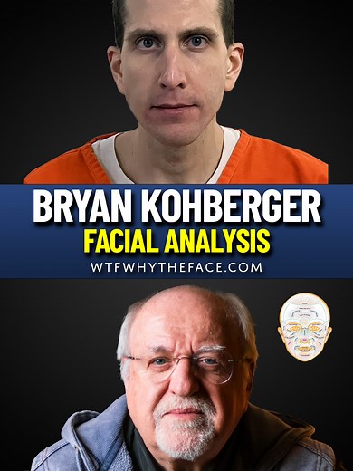 Let's look at Bryan Kohberger. What does his face tell us about hidden traumas, suppressed emotions, and psychological patterns that drive his behavior? Dr. Todd's facial analysis reveals a layered and unsettling portrait of Bryan Kohberger: 🔥