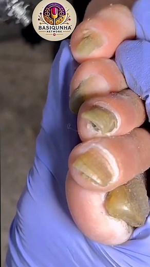 483K views · 796 reactions | Noninvasive foot support tips for calm aging comfort 殺 #noninvasive #seniorhealth #dailywellness | Basiquinha | Facebook