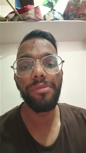 Nested Loop Time Complexity Explained | O(n²) in Simple Terms #timecomplexity #interview #dsa