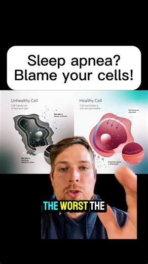 Dylan Petkus, MD, MPH, MS (Not Licensed by Choice) on Instagram: "Your sleep apnea severity is directly tied to how healthy your cells are. (Tap @apneareset to get your clear, personalized path to better sleep) When sleep apnea is severe, oxygen drops happen over and over each night. That intermittent hypoxia quietly damages cells throughout your body. The biggest hit happens to cell membranes. Those membranes control energy, hormones, and repair signals. When membranes break down, energy produc