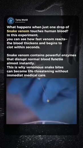 What Snake Venom Does to Human Blood in Seconds. #education #snakevenom #tamuworld