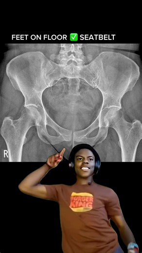 Car Safety Tips: The Dangers of Putting Feet on the Dash