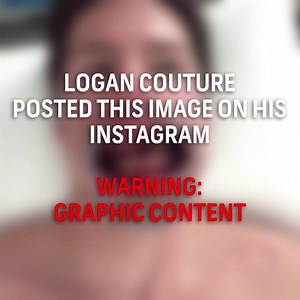 San Jose Sharks forward Logan Couture posted this picture of his face on Instagram. #StanleyCup | NBC Sports EDGE Betting