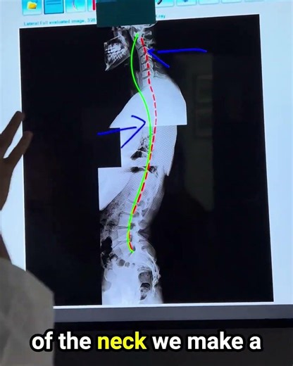 Neck pain after a long flight? ✈️
