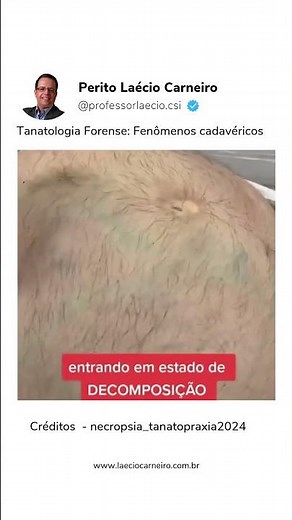 TANATOLOGIA FORENSE | MEDICINA LEGAL | PROF. LAÉCIO