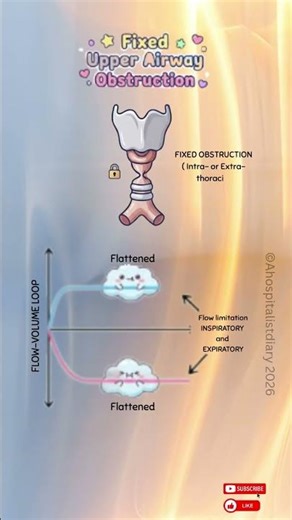 Master PFTs in 3 Minutes: Fixed Upper Airway Obstruction🧠| USMLE & Respiratory Review #shorts#meded