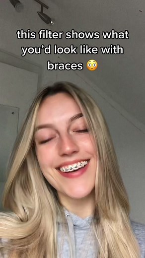 Discover Your Look with Braces Filter