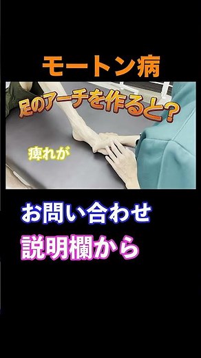 モートン病 改善 整体
