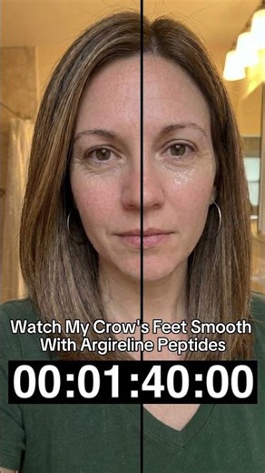 Crow's Feet Treatment at Home: Do Peptides Work?