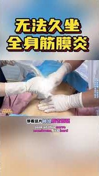 筋膜炎困扰？专家讲解+超声诊断，快来看！ #科普