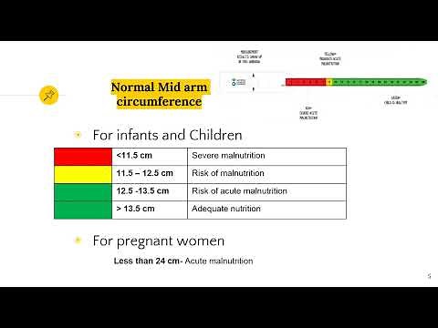 Measuring Mid upper arm circumference