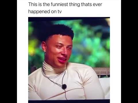 Cockroach lands on mans head on live tv….🙃