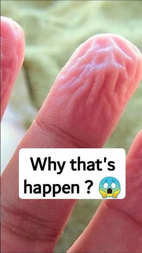 Why Do Fingers Wrinkle in Water? The Science Behind the Mystery!