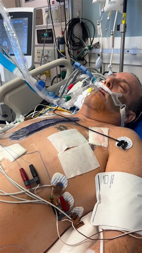 Heidi Love on Instagram: "⚠️ Graphic Medical They say he’s fine. My eyes don’t see that. So I have to trust. I look at him and my heart aches. My throat holds a lump that won’t move. My stomach turns with nausea. I’m floating between being strong and being still… between fear and this gripping tension in my body. Waiting for the moment he wakes up. They’ve kept him sedated and will continue to until things balance enough to slowly reduce it. They assure me he’s okay. They say this can be normal.