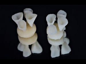 Pressed ceramic veneers & crowns.. lab protocol