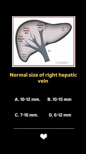 Normal size of right hepatic vein #ultrasound #ultrasoundscan #Ultrasoundtest #ultrasoundtraining #video #ultrasoundtech #short #ultrasoundtherapy #reelsfbシ #ultrasoundcourse #Radiologist | Usg Imaging Study