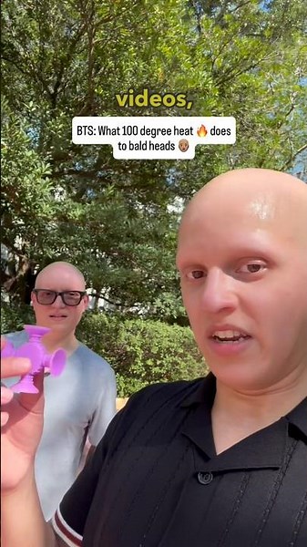 Do bald heads 👨🏽‍🦲 burn in 100 degree heat? 🔥 (BTS) #comedy #funny #alopecia ‪@mcsquared90‬