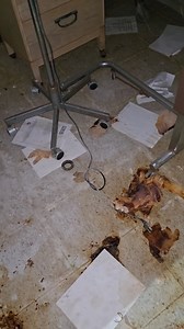 22M views · 74K reactions | DISGUSTING abandoned hospital 濫 #abandonedplaces #abandoned_places #forgottenplaces #abandonedhouse #abandonedbuilding #forgotten #abandonedphotography #decay #abandon_seekers #urbexing | ExploreThings | Facebook