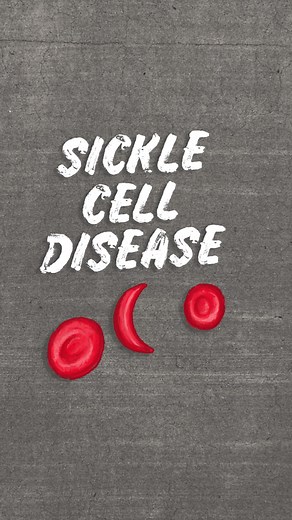 Meet our friend Will! He’s going to help explain how you inherit sickle cell disease. Follow along to see him break down more topics related to sickle cell or visit us as sicklecellspeaks.com for more information. #sicklecellspeaks #sicklecell #sicklecellawareness