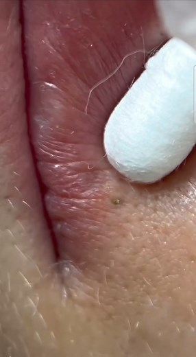 My Lab plus on Reels