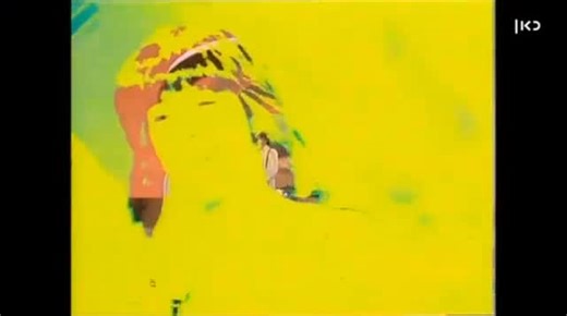 Bonnie Berkovits on Instagram: "List of Israeli 🇮🇱 medical innovations for Spain 🇪🇸, Ireland 🇮🇪, Netherlands 🇳🇱, and Slovenia 🇸🇮 to boycott. @Eurovision • Nano Retina bionic eye tech 👁️ • Endospan aortic repair system ❤️ • BrainsGate stroke therapy 💡 • Syqe inhaler precision-dose cannabis inhaler 🌿 • NeuroDerm Parkinson liquid levodopa pump 🧠 • Kamada plasma derived therapies 💧 • BioLineRx cancer cell therapy 🎯 • InSightec incisionless neurosurgery 🔊 • Remedor wound healing gels