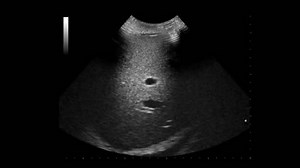 Focused Assessment Sonography Abdominal Trauma Free: стоковое видео (без лицензионных платежей), 1015887766 | Shutterstock