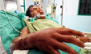 Malaysia's most famous snake-catching fireman dies after being bitten by cobra | Coconuts