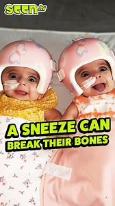 They Were Born With Brittle Bones "My daughters were born with many broken bones and the doctors were worried that they wouldn't make it." Little Mia and Maryam have osteogenesis imperfecta, a disease that makes their bones incredibly fragile. Their mom Rayan takes us through their journey so far, from spending months in the hospital as newborns to learning how to sit up on their own without any help. | seen.tv