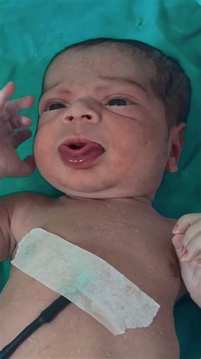 #newbornbabies#nicubabies#nursingstudent#medicalstudent#medicaleducation#babyshorts#cutebaby#likes