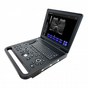 [Hot Item] Clinic 15 Inch LCD Screen Medical Laptop B/W Ultrasound Scanner