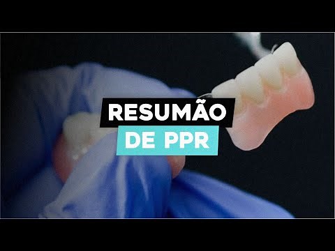 Como Fazer Prótese Parcial Removível: Guia Completo Passo a Passo
