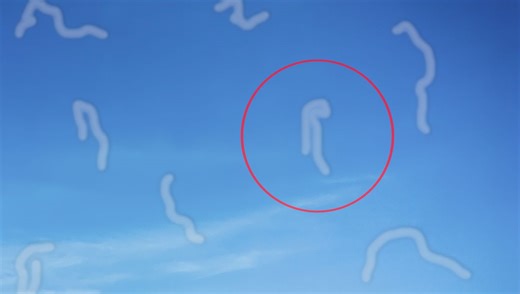 What Are Those Strange Eye "Floaters" You See In Your Vision?