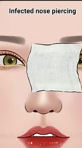 133K views · 755 reactions | ASMR treatment for infected nose piercing video | #animation #3danimation #tranding | Akhilesh Yadav | Facebook